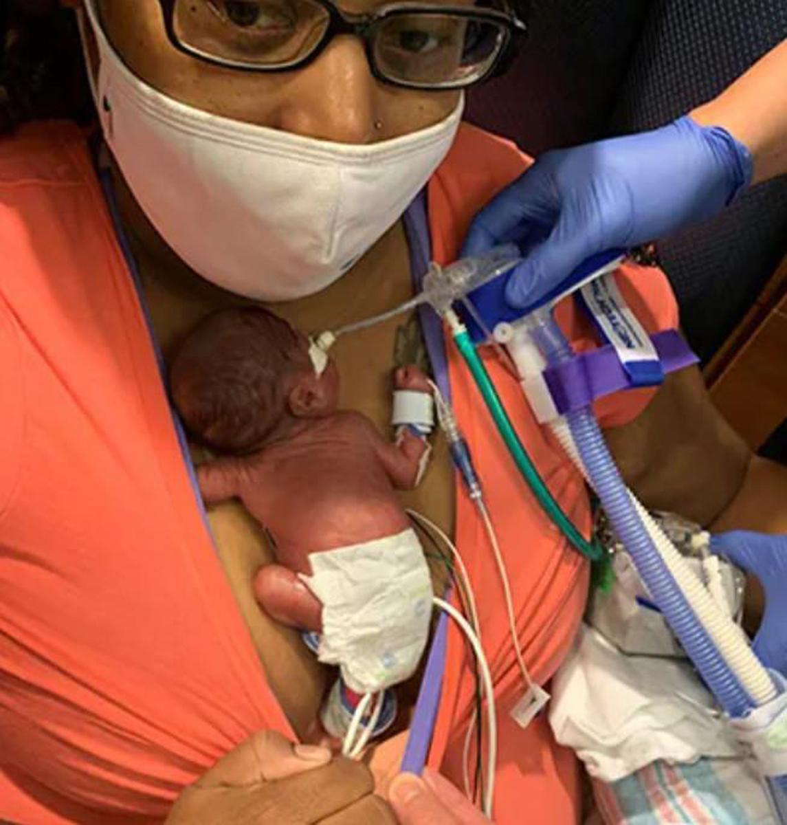 το-πιο-πρόωρο παιδί-που-γεννήθηκε-ποτέ-γιορτάζει-τα-πρώτα-του-γενέθλια-