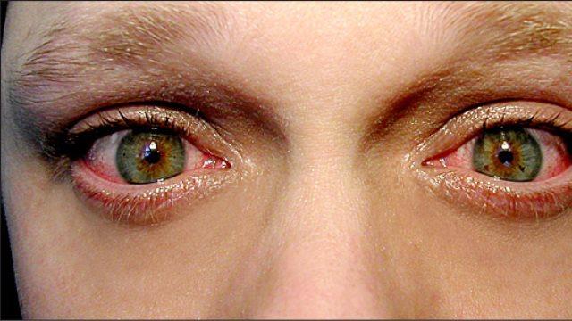 Όλες οι αίτιες που δακρύζουν τα μάτια σας