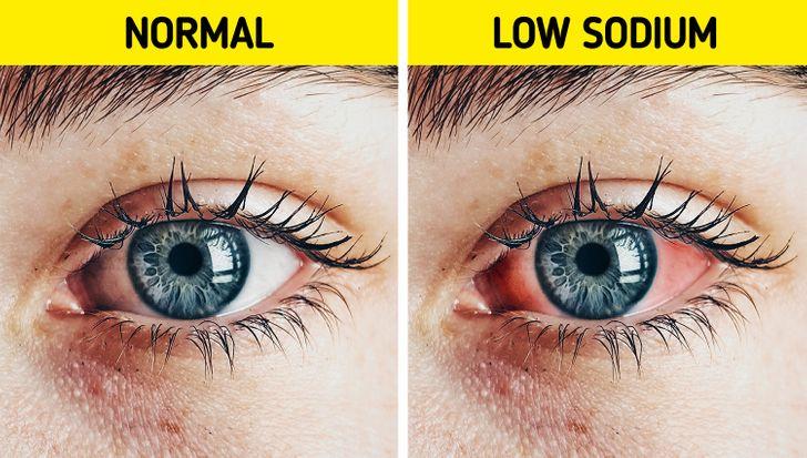 5-πράγματα-που-σημαίνει-ιδρώτας-για-την-υγεία-σας- 5-πράγματα-που-σημαίνει-ιδρώτας-για-την-υγεία-σας-