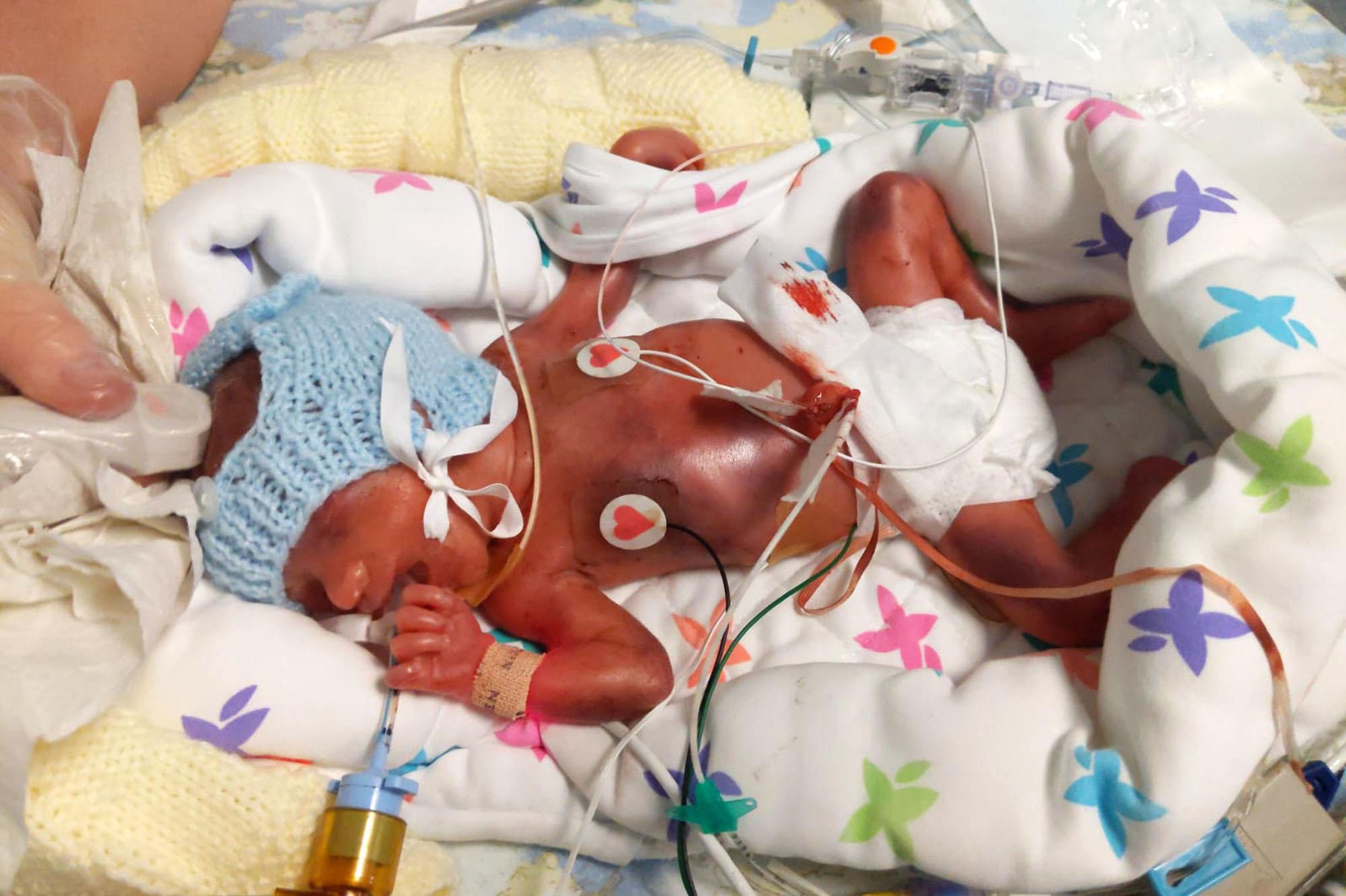 Το ευχάριστο νέο της ημέρας: Μωράκι θα κάνει για πρώτη φορά γιορτές σπίτι  μετά από 2 χρόνια σε νοσοκομείο