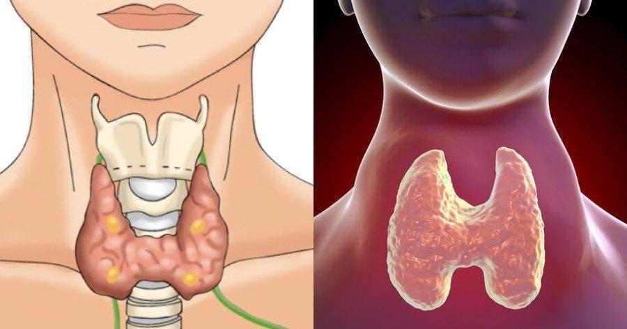 Σοβαρές παθήσεις που έχουν παρόμοια συμπτώματα με το άγχος