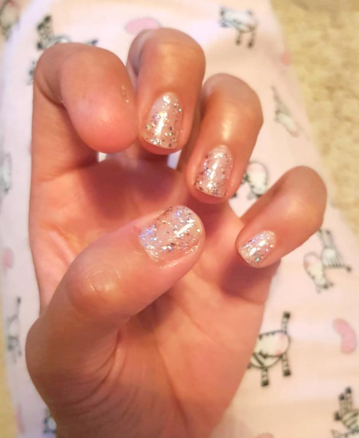 16-άνθρωποι-και-ζώα-που-ξεχωρίζουν-μέσα-από-τη-διαφορετικότητά-τους-