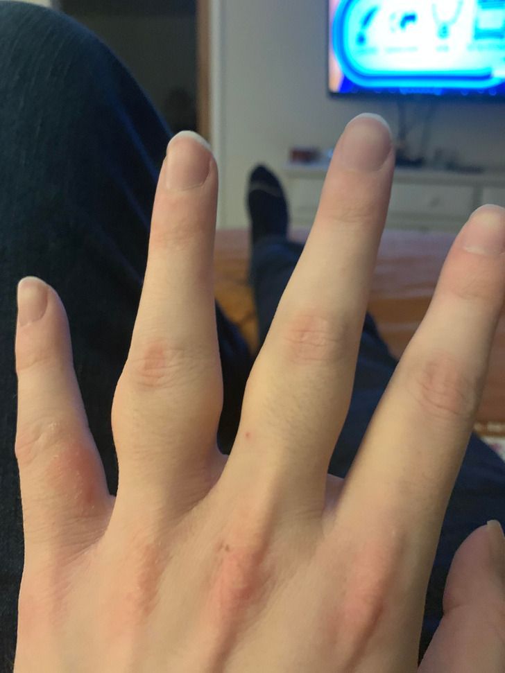 16-άνθρωποι-και-ζώα-που-ξεχωρίζουν-μέσα-από-τη-διαφορετικότητά-τους-