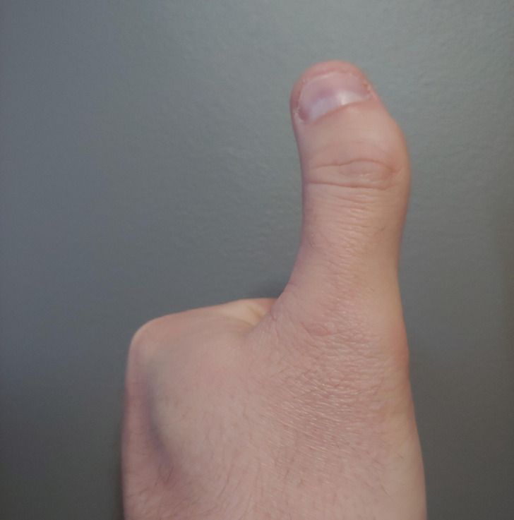 16-άνθρωποι-και-ζώα-που-ξεχωρίζουν-μέσα-από-τη-διαφορετικότητά-τους-