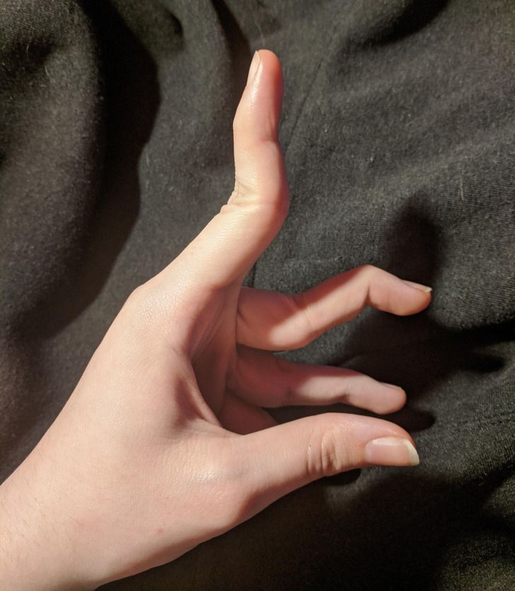 16-άνθρωποι-και-ζώα-που-ξεχωρίζουν-μέσα-από-τη-διαφορετικότητά-τους-