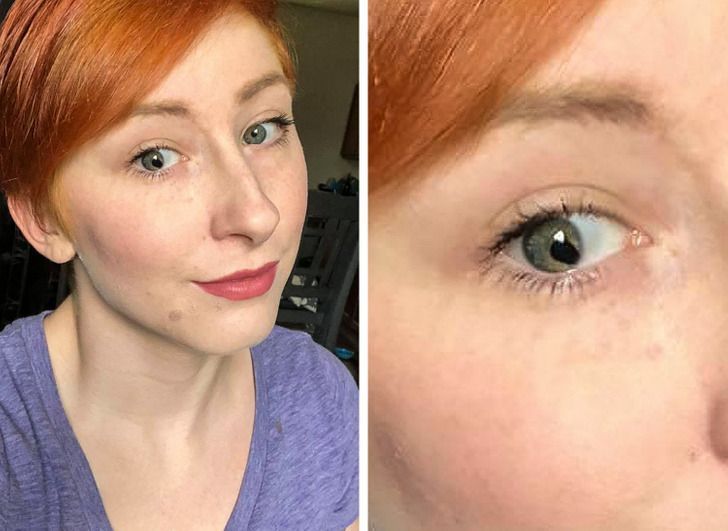 16-άνθρωποι-και-ζώα-που-ξεχωρίζουν-μέσα-από-τη-διαφορετικότητά-τους-