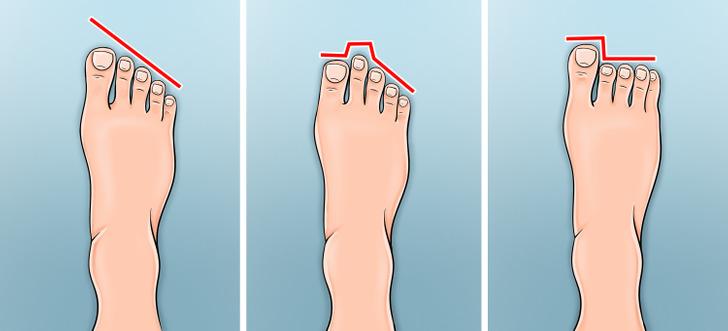 χαρακτηριστικά-στο-σώμα-που-αποκαλύπτουν-στοιχεία-για-την-καταγωγή-και-τον-χαρακτήρα- χαρακτηριστικά-στο-σώμα-που-αποκαλύπτουν-στοιχεία-για-την-καταγωγή-και-τον-χαρακτήρα-