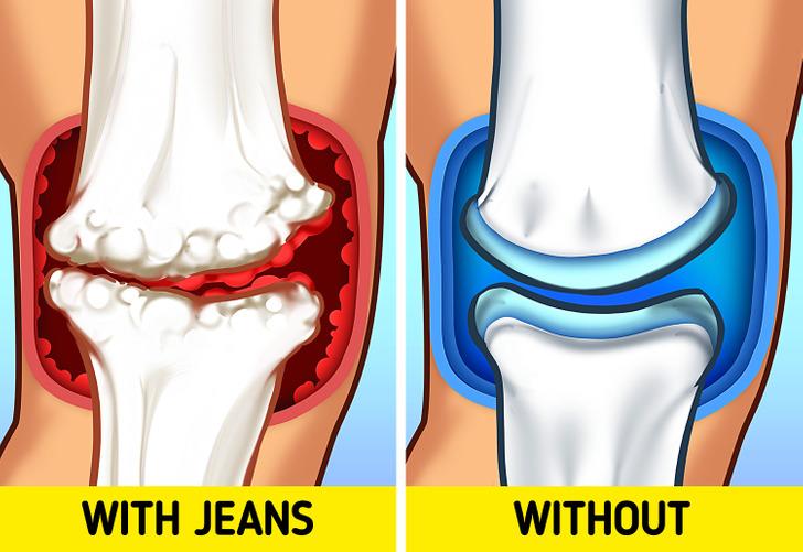 ποια-προβλήματα υγείας-δημιουργεί-το-τζιν παντελόνι- ποια-προβλήματα υγείας-δημιουργεί-το-τζιν παντελόνι-