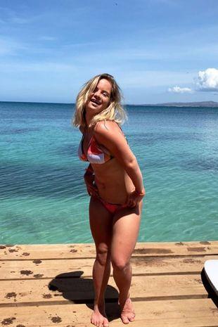 το-νέο-μοντέλο-της-victoria'secret-έχει-σύνδρομο down-