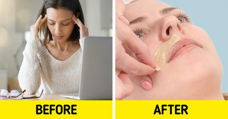 λόγοι-για-τους-οποίους-έχετε-τρίχες-στο-πρόσωπο-