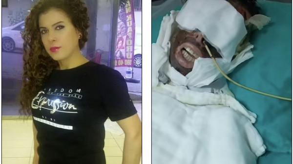 Yasemin-Uzuncelebi-Πριν-Μετά