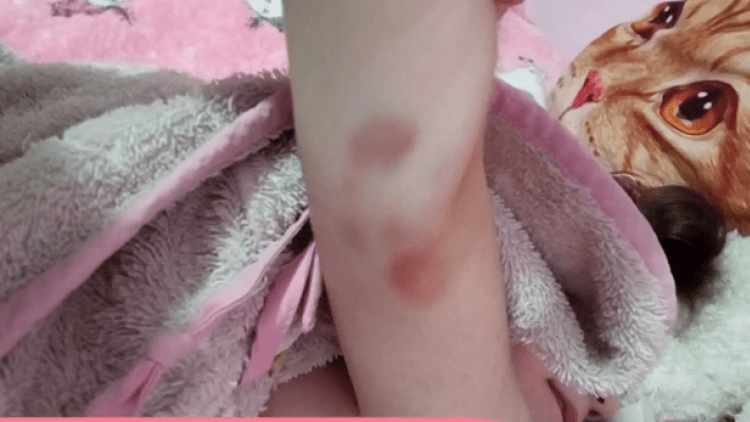 Πάτρα-Τζωρτζίνα-Μελανιές Πάτρα-Τζωρτζίνα-Μελανιές