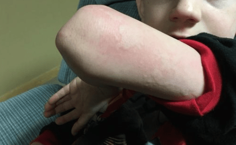 το-σοβαρό-σύμπτωμα-της-γρίπης-που-λίγοι-γνωρίζουν- το-σοβαρό-σύμπτωμα-της-γρίπης-που-λίγοι-γνωρίζουν-