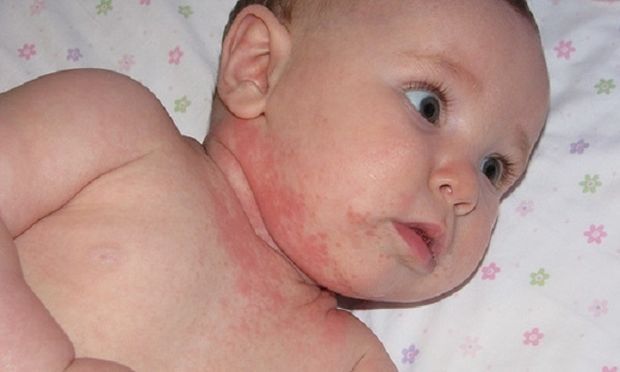 το-σοβαρό-σύμπτωμα-της-γρίπης-που-λίγοι-γνωρίζουν- το-σοβαρό-σύμπτωμα-της-γρίπης-που-λίγοι-γνωρίζουν-