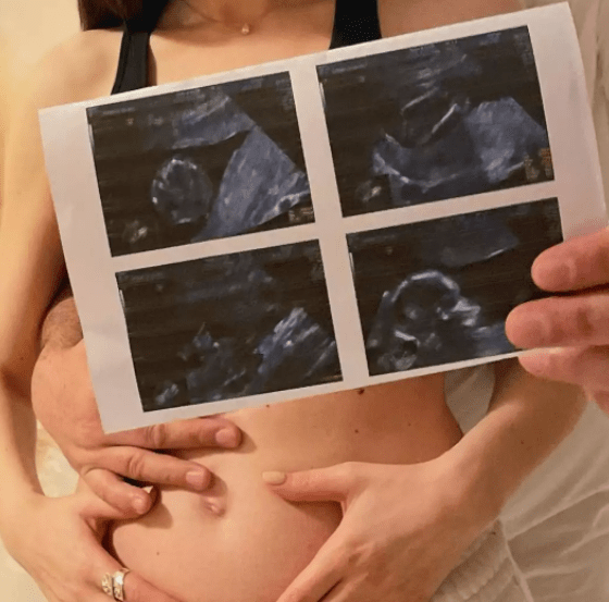 Μάνος Μαγιάτης-ετοιμάζεται-να-γίνει-πατέρας- Μάνος Μαγιάτης-ετοιμάζεται-να-γίνει-πατέρας-