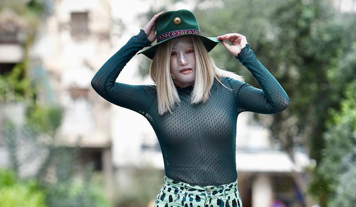 Ιωάννα Παλιοσπύρου: Δείχνει το πρόσωπο της και περιγράφει τις σοκαριστικές στιγμές της επίθεσης με το βιτριόλι