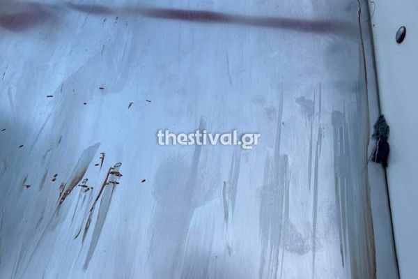 Κόπηκε το δάκτυλο μικρού παιδιού σε τσουλήθρα παιδικής χαράς!