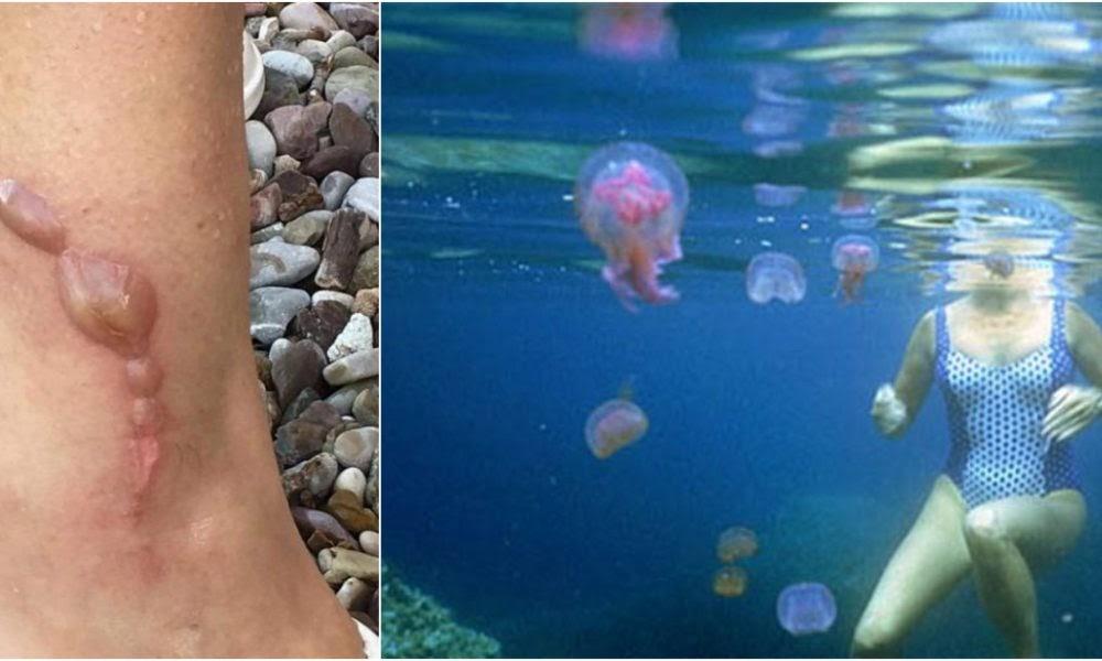 Μωβ-μέδουσα