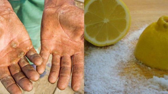 Πως να καθαρίσετε την σκουριά από τα χέρια σας