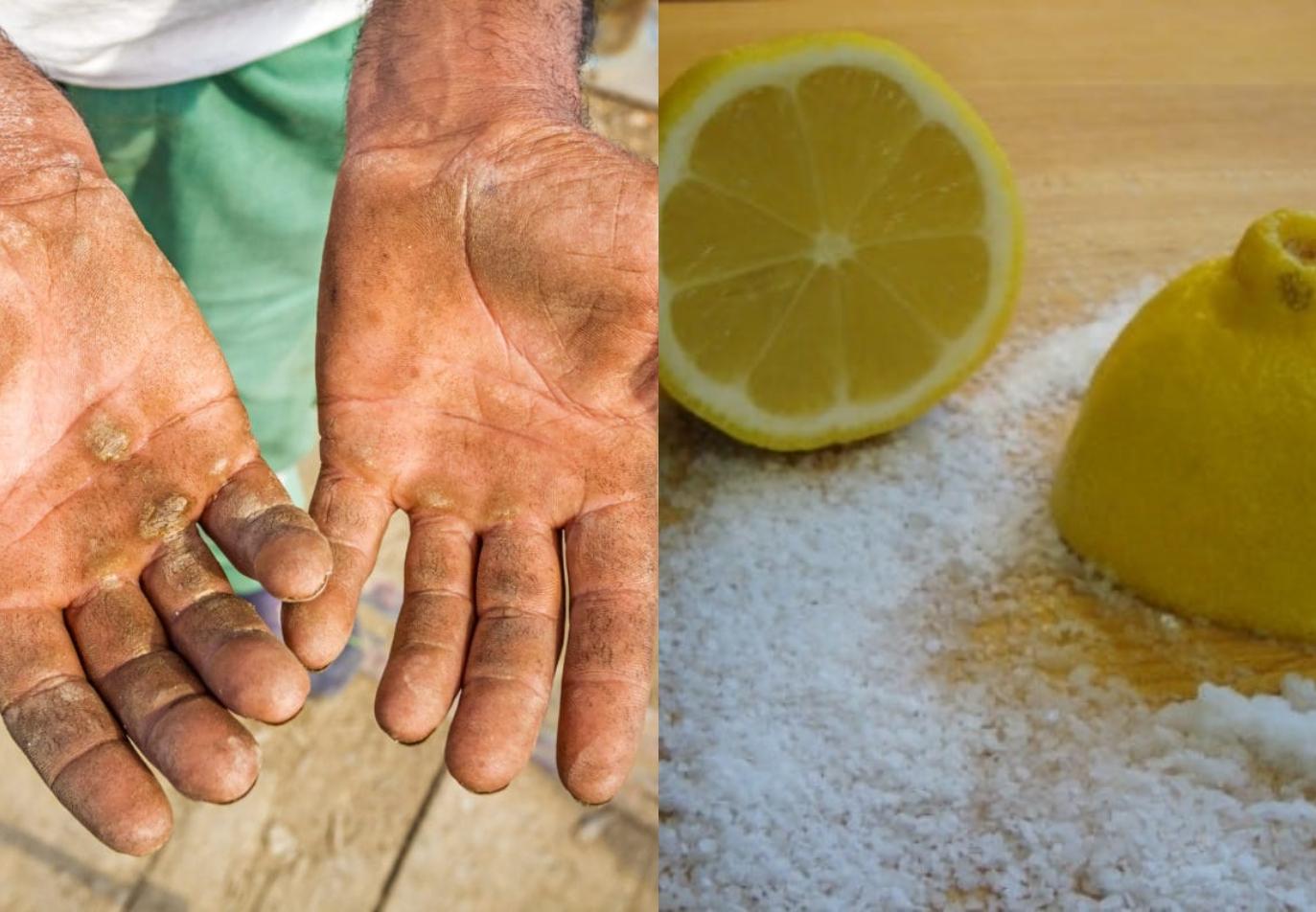 Πως να καθαρίσετε την σκουριά από τα χέρια σας
