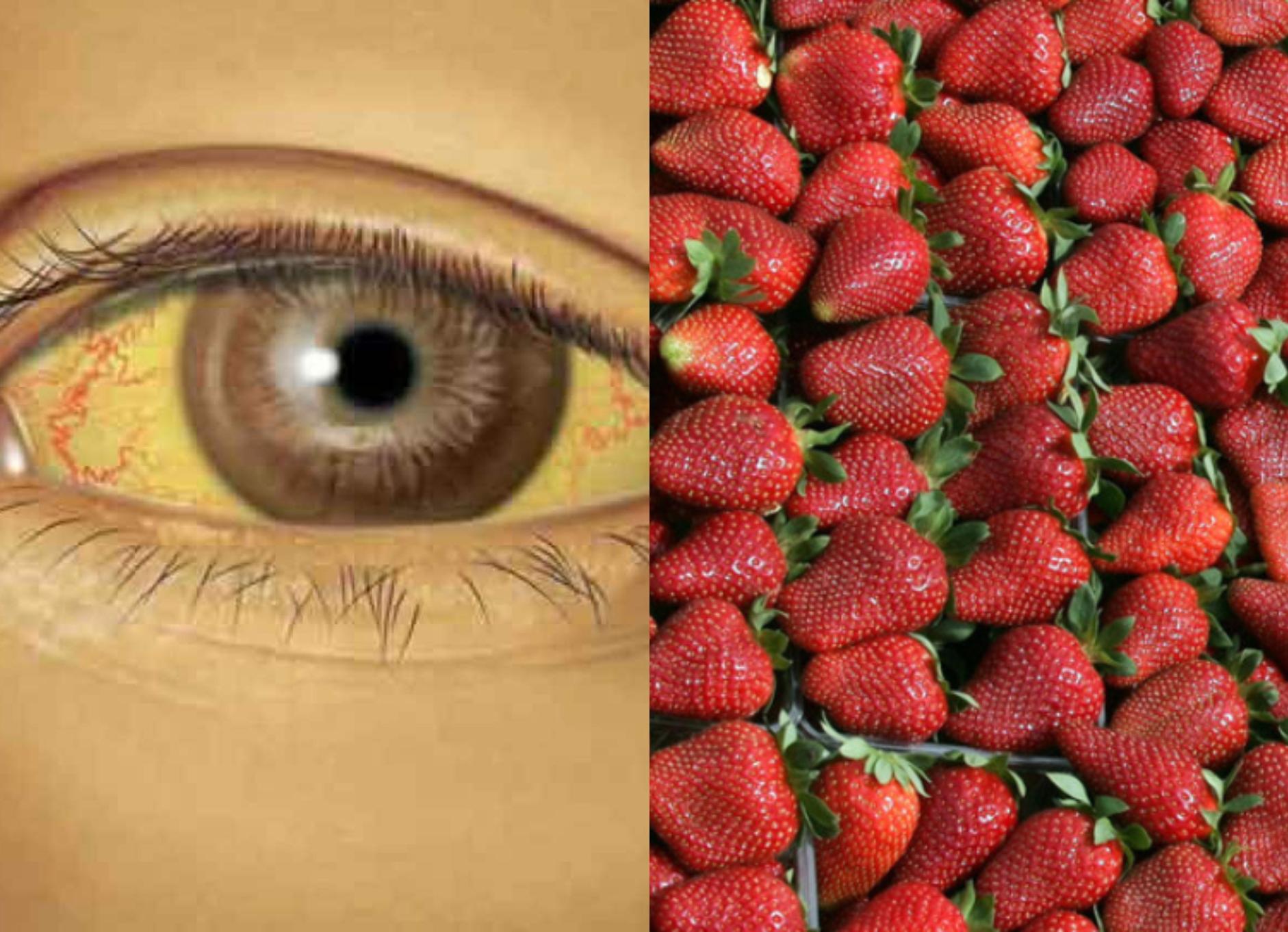Ηπατίτιδα Α: Ευθύνονται οι φράουλες για κρούσματα;