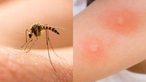 γιατί-τα-κουνούπια-τσιμπούν-εσάς-