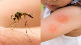 Τσίμπημα κουνουπιών: Αυτή την βιταμίνη χρειαζόμαστε για να μην μας τσιμπάνε