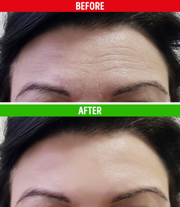 6-έλαια-για-αντιγήρανση- 6-έλαια-για-αντιγήρανση-