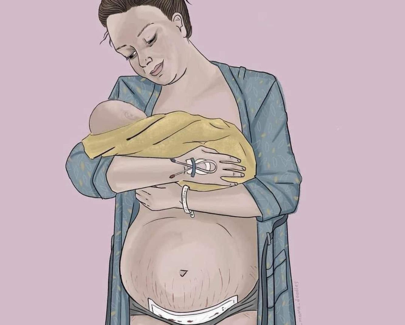 Πάρε μία αγκαλιά την μητέρα και όχι το μωρό