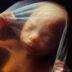 Παιδιά Φρανκενστάιν: Ερευνητές έφτιαξαν το πρώτο «συνθετικό έμβρυο» στον κόσμο