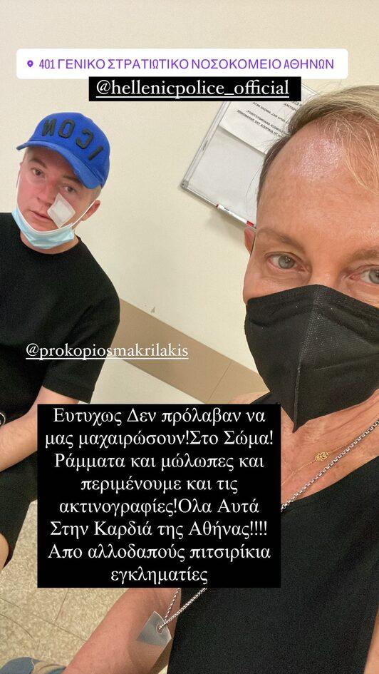 Θύμα άγριας επίθεσης από αλλοδαπούς στην Αθήνα ο Βασίλειος Κωτσέτσος – Εικόνες