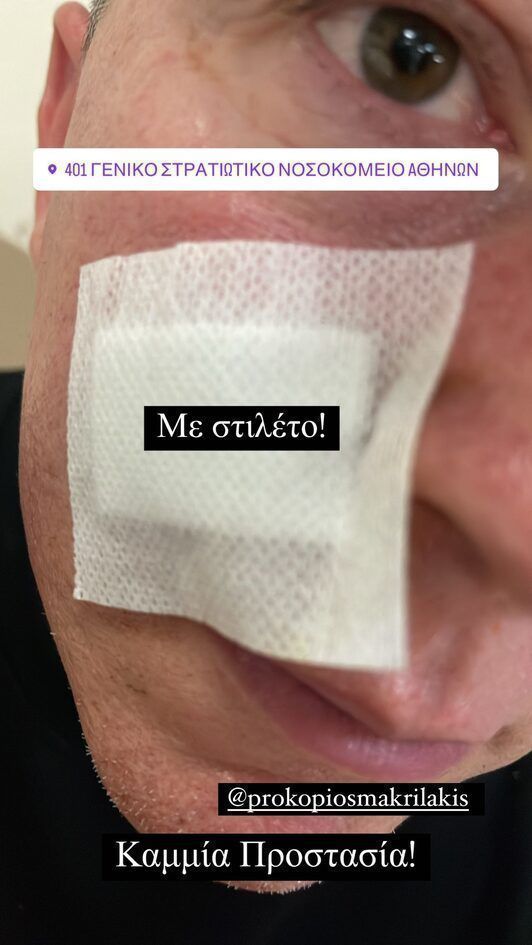 Θύμα άγριας επίθεσης από αλλοδαπούς στην Αθήνα ο Βασίλειος Κωτσέτσος – Εικόνες