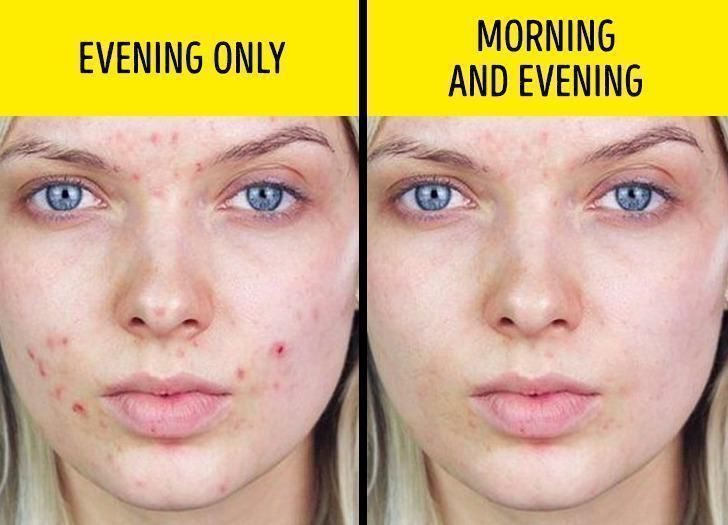 8-προϊόντα ομορφιάς-που-χρησιμοποιούμε-λάθος-