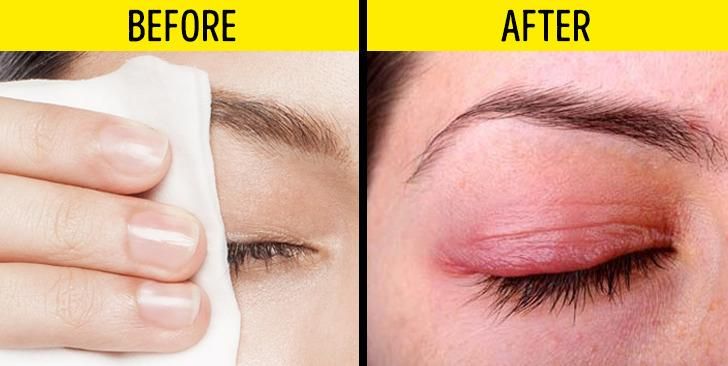 8-προϊόντα ομορφιάς-που-χρησιμοποιούμε-λάθος-