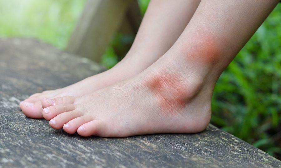 Έκτακτη ανακοίνωση ΕΟΔΥ : Σε έξαρση τα μολυσμένα κουνούπια στην Ελλάδα – Ποιοι θα πρέπει να προσέχουν ιδιαιτέρως