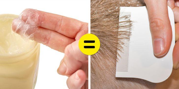 σπιτικές θεραπείες-για-ψείρες-και-κόνιδες- σπιτικές θεραπείες-για-ψείρες-και-κόνιδες-