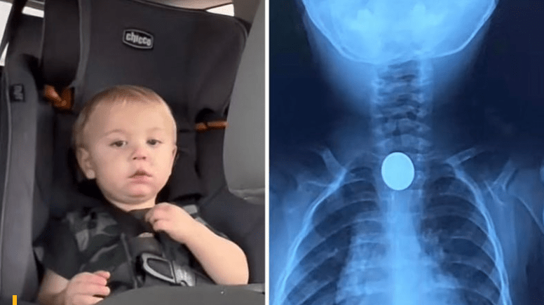 παιδί-κατάπιε κέρμα-και-παραλίγο-να-πεθάνει- παιδί-κατάπιε κέρμα-και-παραλίγο-να-πεθάνει-