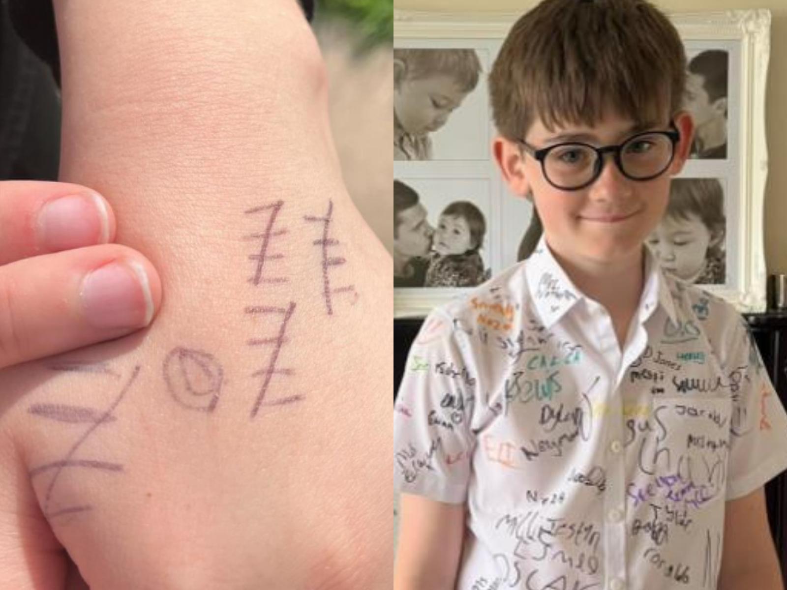 έφηβος-ζωγραφίζει-γραμμές-στα-χέρια-κάθε-φορά-που-δέχεται-bullying-στο-σχολείο-σχολικός εκφοβισμός-