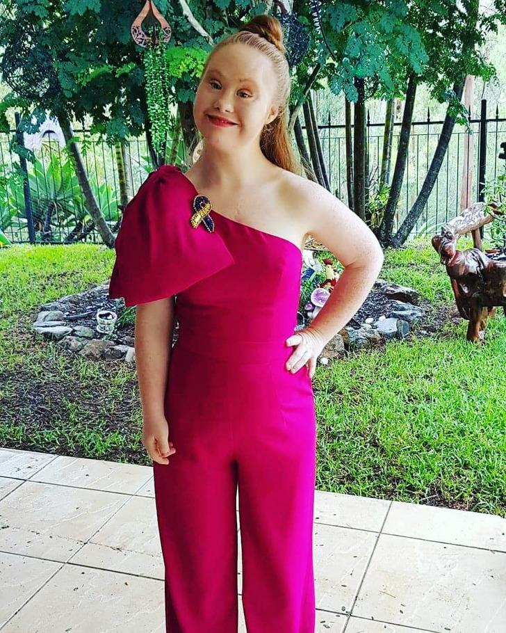 Madeline Stuart-η-ιστορία-για-το-μοντέλο-με-σύνδρομο down-και-αυτισμό- Madeline Stuart-η-ιστορία-για-το-μοντέλο-με-σύνδρομο down-και-αυτισμό-