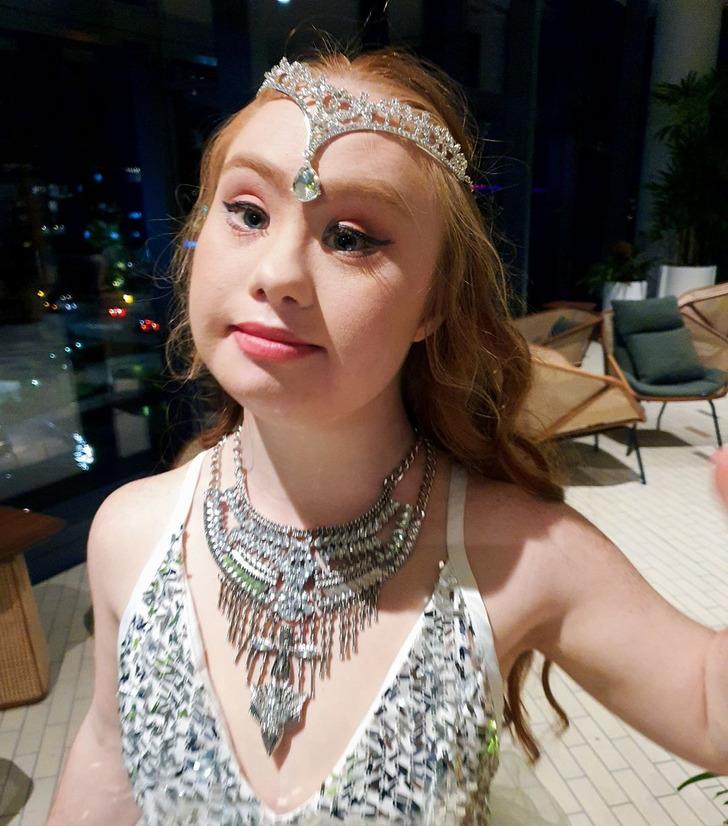 Madeline Stuart-η-ιστορία-για-το-μοντέλο-με-σύνδρομο down-και-αυτισμό- Madeline Stuart-η-ιστορία-για-το-μοντέλο-με-σύνδρομο down-και-αυτισμό-