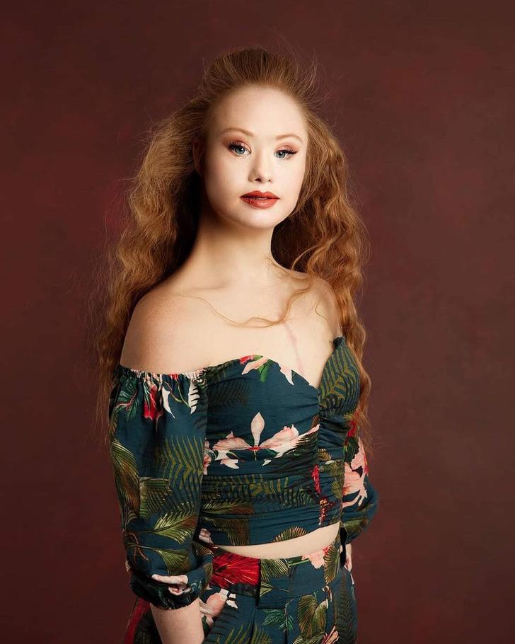 Madeline Stuart-η-ιστορία-για-το-μοντέλο-με-σύνδρομο down-και-αυτισμό- Madeline Stuart-η-ιστορία-για-το-μοντέλο-με-σύνδρομο down-και-αυτισμό-