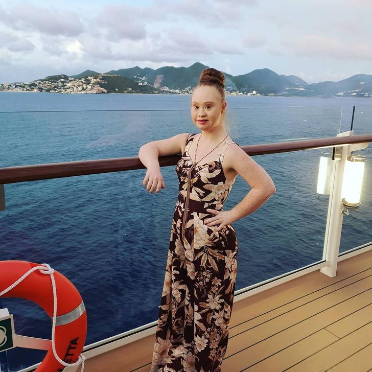 Madeline Stuart-η-ιστορία-για-το-μοντέλο-με-σύνδρομο down-και-αυτισμό- Madeline Stuart-η-ιστορία-για-το-μοντέλο-με-σύνδρομο down-και-αυτισμό-