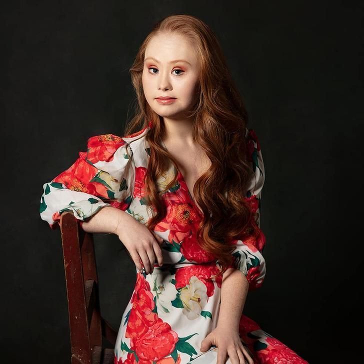 Madeline Stuart-η-ιστορία-για-το-μοντέλο-με-σύνδρομο down-και-αυτισμό- Madeline Stuart-η-ιστορία-για-το-μοντέλο-με-σύνδρομο down-και-αυτισμό-