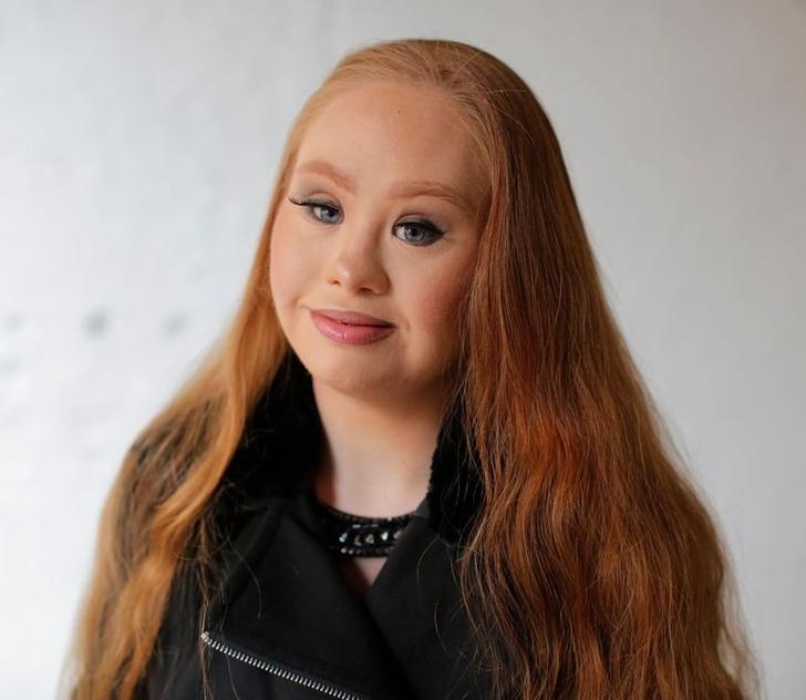 Madeline Stuart-η-ιστορία-για-το-μοντέλο-με-σύνδρομο down-και-αυτισμό- Madeline Stuart-η-ιστορία-για-το-μοντέλο-με-σύνδρομο down-και-αυτισμό-