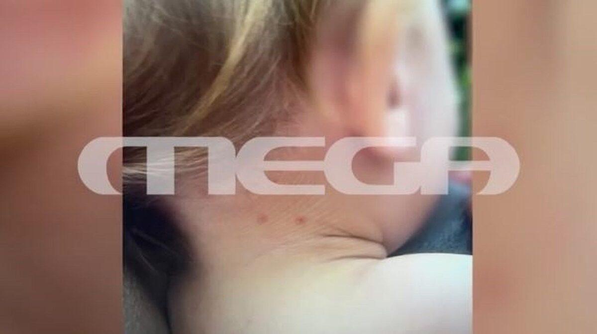 Καβάλα: Δεν την πήγε στο μαιευτήριο να γεννήσει, το μωρό ήταν τσιμπημένο από ψύλλους – Εικόνες