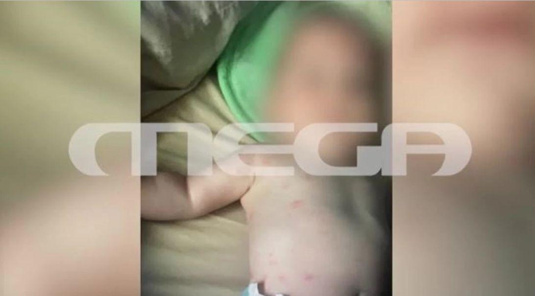 Καβάλα: Δεν την πήγε στο μαιευτήριο να γεννήσει, το μωρό ήταν τσιμπημένο από ψύλλους – Εικόνες