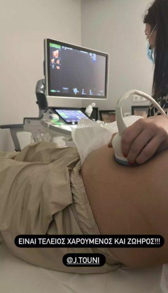 Ιωάννα Τούνη: To υπερηχογράφημα με τον Δημήτρη Αλεξάνδρου στο πλευρό της