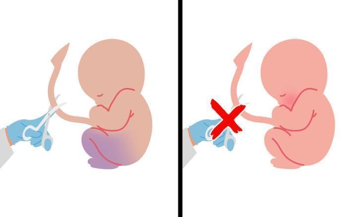 πράγματα-που-επηρεάζουν-την-εμφάνιση-του-παιδιού-κατά-την-εγκυμοσύνη- πράγματα-που-επηρεάζουν-την-εμφάνιση-του-παιδιού-κατά-την-εγκυμοσύνη-