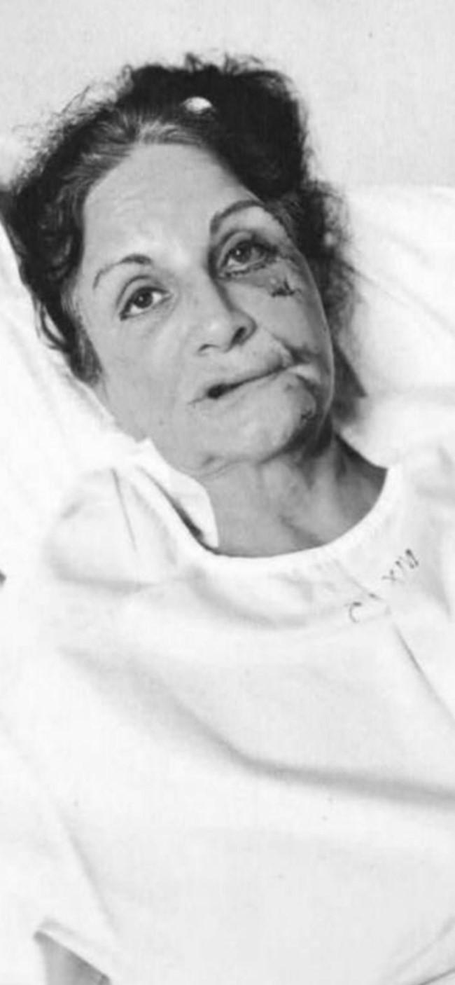 Αίγινα: Κόντεψαν να σκοτώσουν στο ξύλο την 67χρονη επιχειρηματία για 700 ευρώ