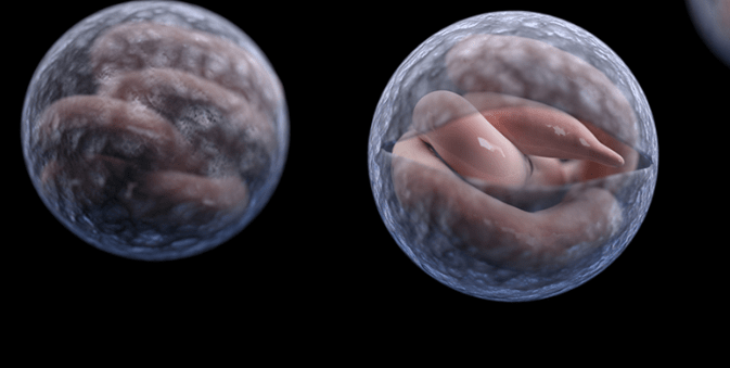 Παράσιτα στο σώμα: Τα συμπτώματα για να τα αναγνωρίσετε και ένα φυσικό αντιπαρασιτικό για να τα διώξετε